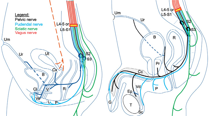 Delayed Orgasm From Lumbosacral Disc Disease Role of the